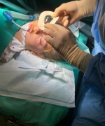 Wizjoner Okulistyka - Operacja usunięcia zeza