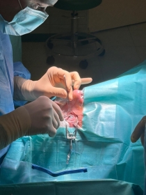 Operacyjne leczenie zeza