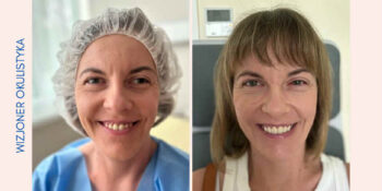 Czy zez może cofnąć się samoistnie?