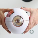 Co można robić po operacji zeza?